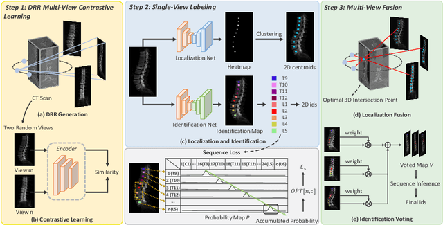 Figure 1 for Multi-View Vertebra Localization and Identification from CT Images