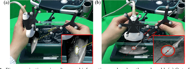 Figure 1 for Navigate Biopsy with Ultrasound under Augmented Reality Device: Towards Higher System Performance