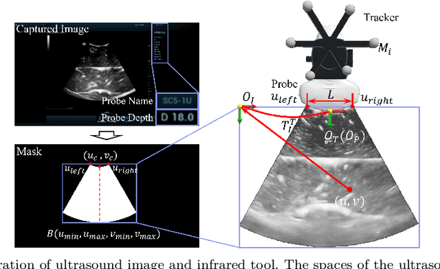 Figure 3 for Navigate Biopsy with Ultrasound under Augmented Reality Device: Towards Higher System Performance