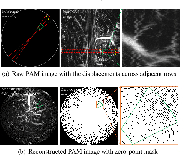 Figure 1 for Super-Resolution on Rotationally Scanned Photoacoustic Microscopy Images Incorporating Scanning Prior