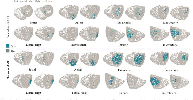 Figure 3 for Towards Enabling Cardiac Digital Twins of Myocardial Infarction Using Deep Computational Models for Inverse Inference