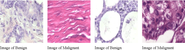 Figure 1 for A study on Deep Convolutional Neural Networks, Transfer Learning and Ensemble Model for Breast Cancer Detection