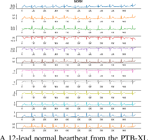 Figure 2 for Love or Hate? Share or Split? Privacy-Preserving Training Using Split Learning and Homomorphic Encryption
