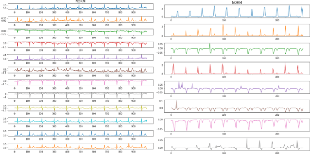 Figure 4 for Love or Hate? Share or Split? Privacy-Preserving Training Using Split Learning and Homomorphic Encryption