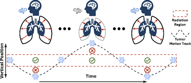 Figure 1 for Patient-Specific Autoregressive Models for Organ Motion Prediction in Radiotherapy