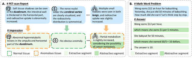 Figure 1 for AS-ES Learning: Towards Efficient CoT Learning in Small Models