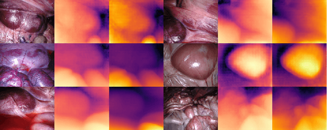 Figure 3 for Towards Full-parameter and Parameter-efficient Self-learning For Endoscopic Camera Depth Estimation