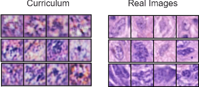 Figure 3 for End to End Generative Meta Curriculum Learning For Medical Data Augmentation