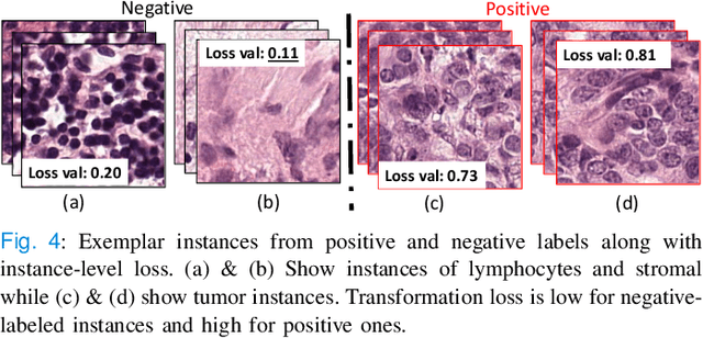 Figure 4 for Unsupervised Mutual Transformer Learning for Multi-Gigapixel Whole Slide Image Classification