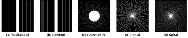 Figure 3 for Deep Cardiac MRI Reconstruction with ADMM