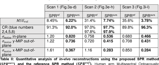 Figure 4 for A Method for Accurate Spatial Focusing Simulation via Numerical Integration and its Application in Optoacoustic Tomography