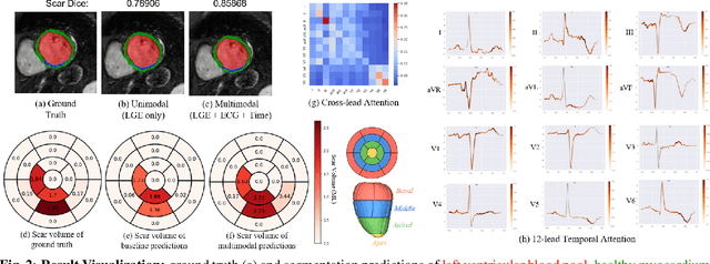 Figure 3 for Seeing Beyond the Image: ECG and Anatomical Knowledge-Guided Myocardial Scar Segmentation from Late Gadolinium-Enhanced Images