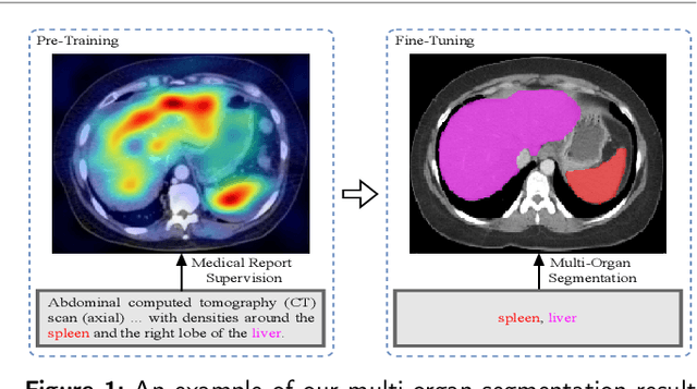 Figure 1 for MOSMOS: Multi-organ segmentation facilitated by medical report supervision