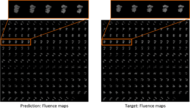 Figure 4 for A Beam's Eye View to Fluence Maps 3D Network for Ultra Fast VMAT Radiotherapy Planning