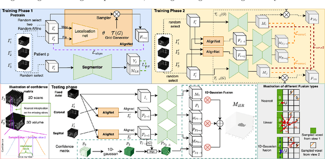 Figure 3 for SuperMask: Generating High-resolution object masks from multi-view, unaligned low-resolution MRIs