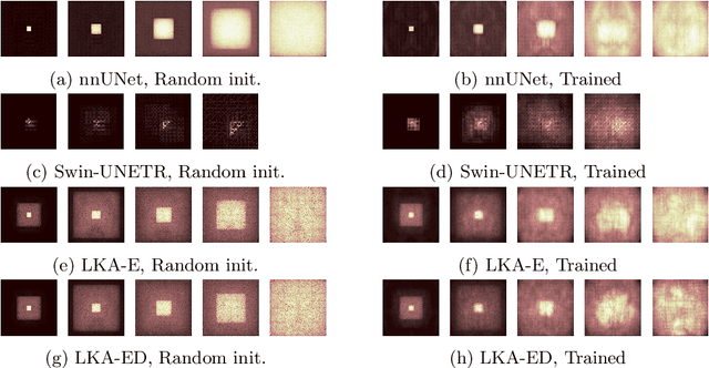 Figure 2 for Large-kernel Attention for Efficient and Robust Brain Lesion Segmentation