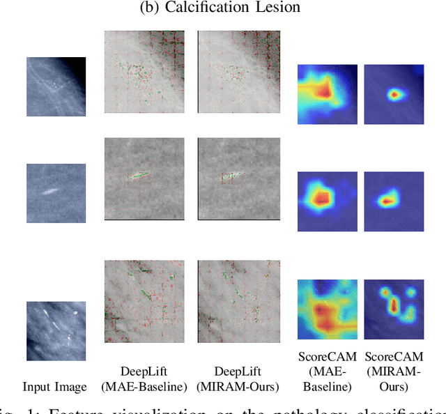Figure 1 for MIRAM: Masked Image Reconstruction Across Multiple Scales for Breast Lesion Risk Prediction