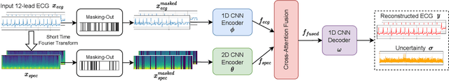 Figure 1 for TSRNet: Simple Framework for Real-time ECG Anomaly Detection with Multimodal Time and Spectrogram Restoration Network