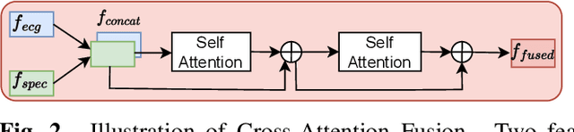Figure 3 for TSRNet: Simple Framework for Real-time ECG Anomaly Detection with Multimodal Time and Spectrogram Restoration Network