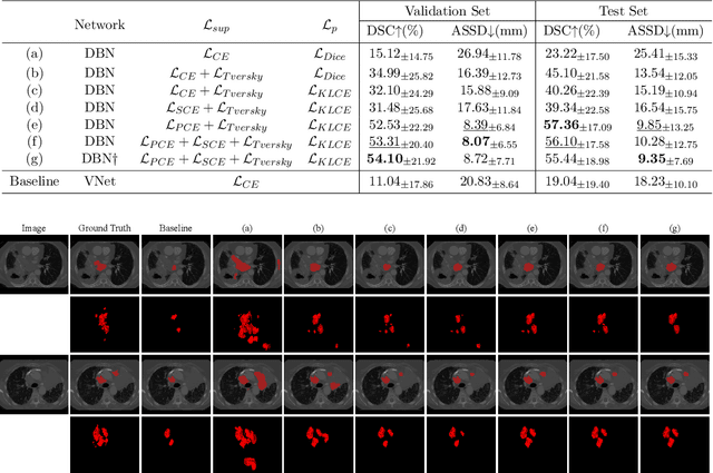 Figure 2 for Weakly Supervised Lymph Nodes Segmentation Based on Partial Instance Annotations with Pre-trained Dual-branch Network and Pseudo Label Learning