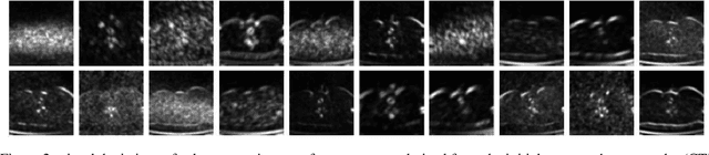 Figure 3 for Invariant Scattering Transform for Medical Imaging