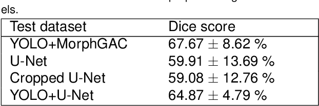 Figure 4 for Detection and Segmentation of Pancreas using Morphological Snakes and Deep Convolutional Neural Networks