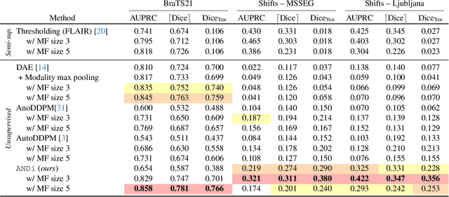 Figure 2 for Unsupervised Anomaly Detection using Aggregated Normative Diffusion