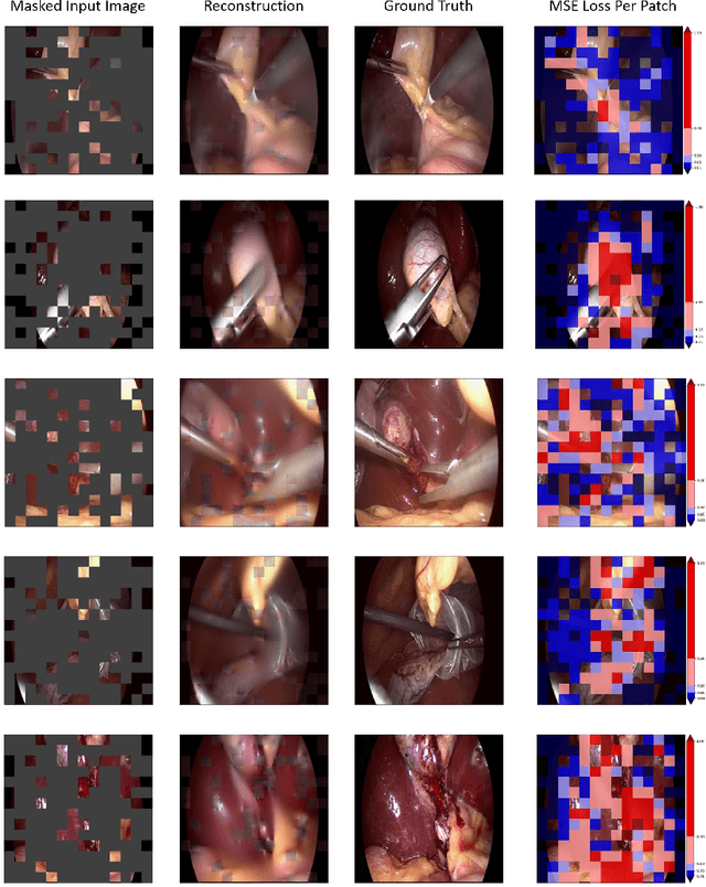 Figure 4 for Whether and When does Endoscopy Domain Pretraining Make Sense?