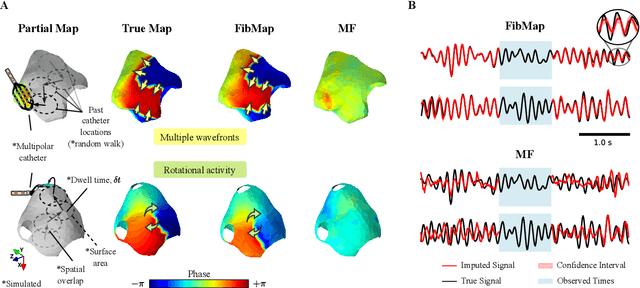 Figure 4 for Learning to Predict Global Atrial Fibrillation Dynamics from Sparse Measurements