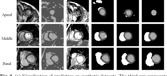 Figure 4 for Unsupervised Cardiac Segmentation Utilizing Synthesized Images from Anatomical Labels