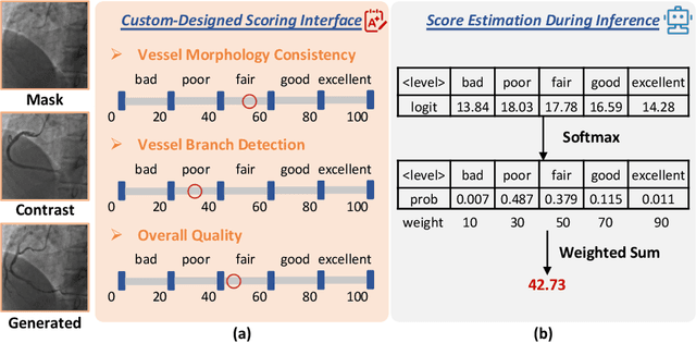 Figure 3 for CAS-IQA: Teaching Vision-Language Models for Synthetic Angiography Quality Assessment