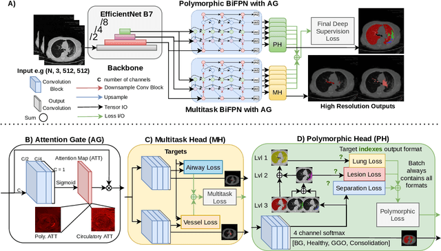 Figure 3 for MEDPSeg: End-to-end segmentation of pulmonary structures and lesions in computed tomography