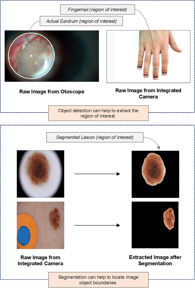 Figure 3 for Towards Implementing Energy-aware Data-driven Intelligence for Smart Health Applications on Mobile Platforms