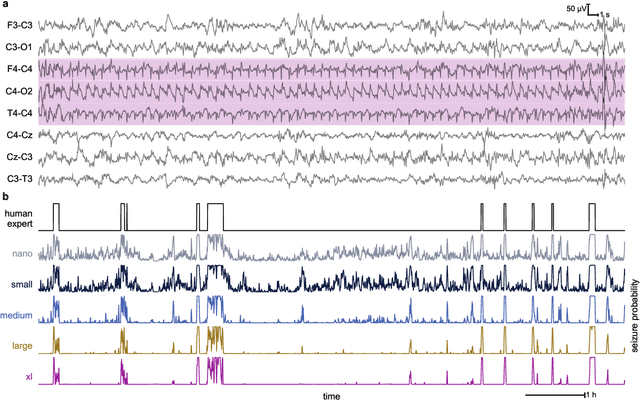 Figure 1 for Scaling convolutional neural networks achieves expert-level seizure detection in neonatal EEG