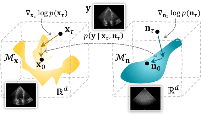 Figure 1 for Deep Generative Models for Bayesian Inference on High-Rate Sensor Data: Applications in Automotive Radar and Medical Imaging