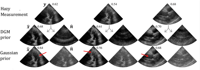 Figure 2 for Deep Generative Models for Bayesian Inference on High-Rate Sensor Data: Applications in Automotive Radar and Medical Imaging