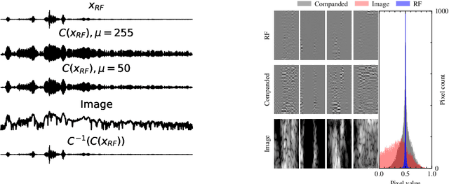 Figure 3 for Deep Generative Models for Bayesian Inference on High-Rate Sensor Data: Applications in Automotive Radar and Medical Imaging