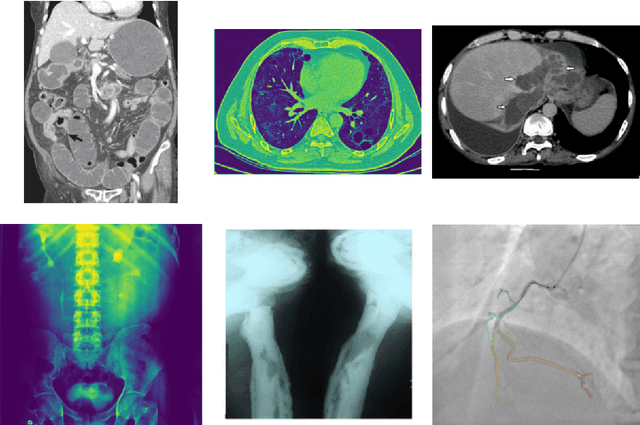 Figure 2 for UIT-DarkCow team at ImageCLEFmedical Caption 2024: Diagnostic Captioning for Radiology Images Efficiency with Transformer Models