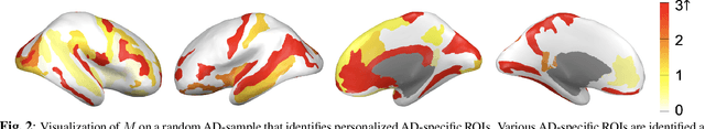 Figure 3 for Learning Covariance-Based Multi-Scale Representation of Neuroimaging Measures for Alzheimer Classification