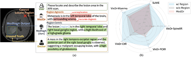 Figure 3 for Interpretable Bilingual Multimodal Large Language Model for Diverse Biomedical Tasks