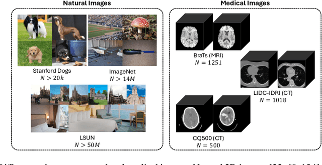 Figure 1 for Deep Generative Models for 3D Medical Image Synthesis